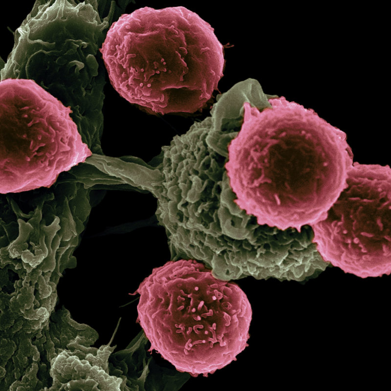 A scanning electron microscope image shows dendritic cells, pseudo-colored in green, interacting with T cells, pseudo-colored in pink.